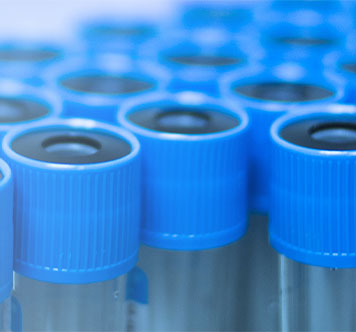 PRP Treatment Indianapolis - PRP Treatment Greenwood IN - Greenwood Orthopaedics - Platelet Rich Plasma - PRP injections - PRP for chronic pain 